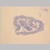 Intestino Delgado 13.jpg